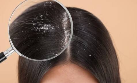 Doctor explains how pollution hurts scalp and hair quality
