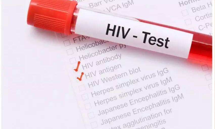 Can diet and exercise help you live well with HIV?