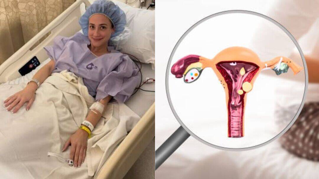 Lili Reinhart diagnosed with endometriosis after dismissal 