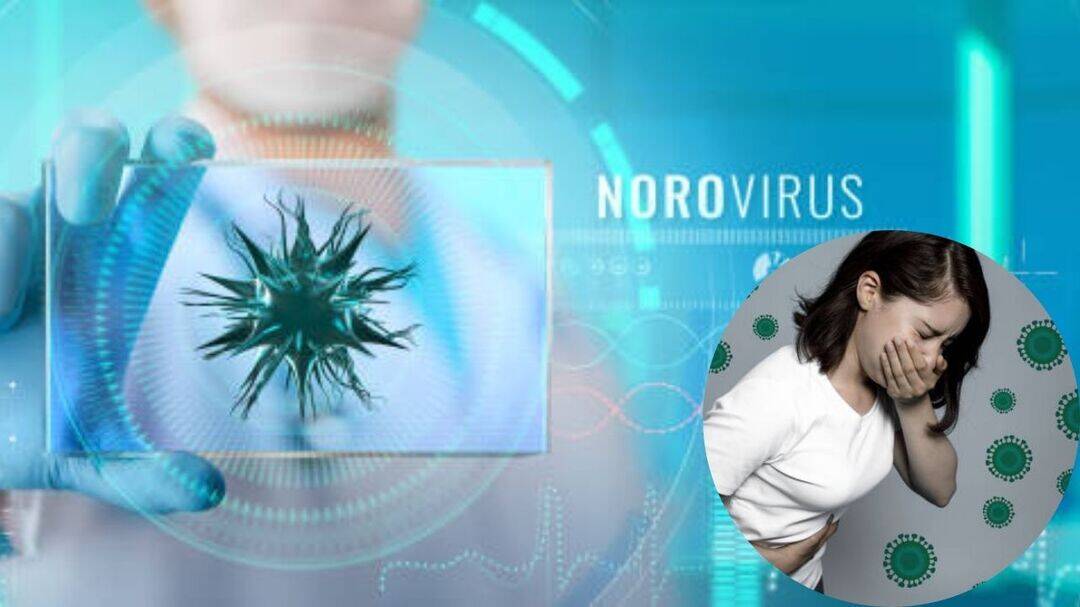 Norovirus cases surge in US; handwashing crucial to stop spread