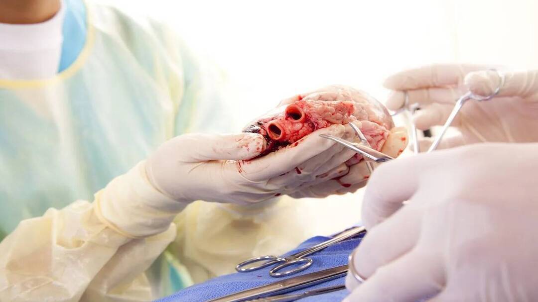 65% of country's heart transplants performed only in South India