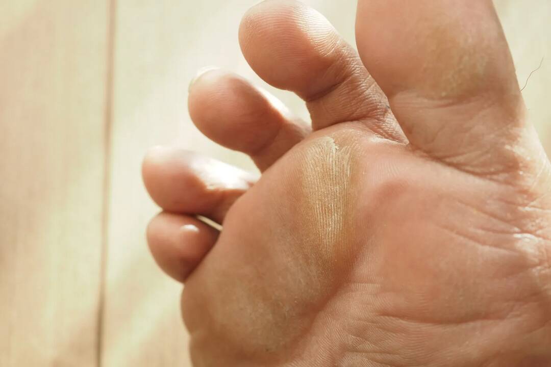 Why does the skin of feet get hard and thick over time?
