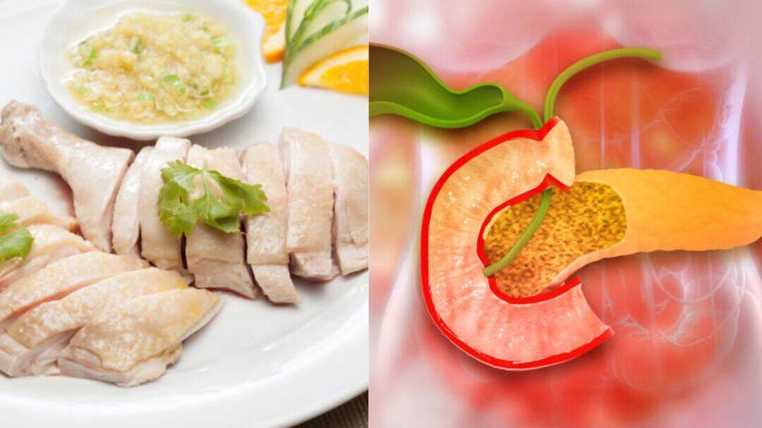 Chinese influencer develops pancreatitis on boiled chicken diet
