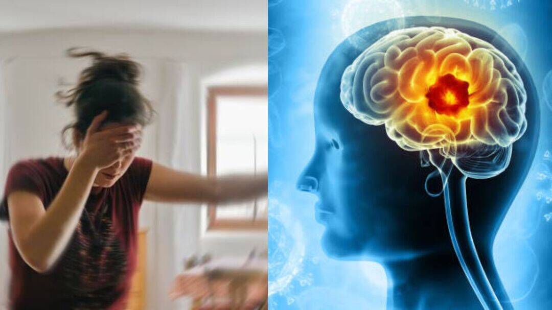 Atypical stroke symptoms put women at greater risk: Expert