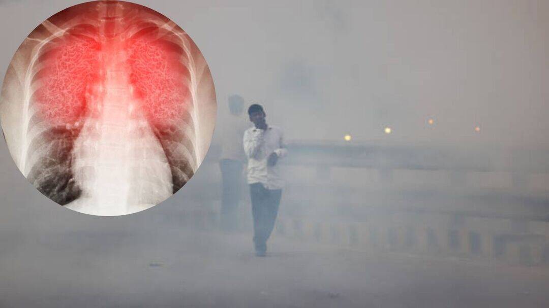 Delhi pollution causing silent lung inflammation in young people