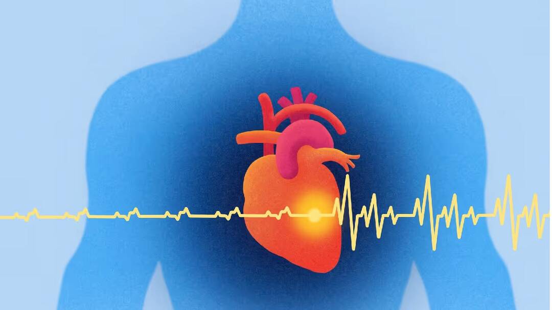 Study finds some plant-based foods may increase heart disease risk