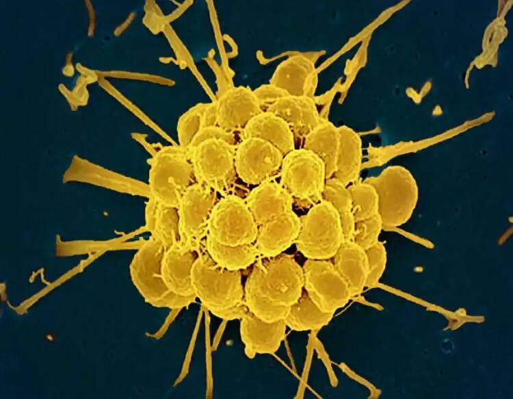 New FDA-approved antibiotics target drug-resistant gonorrhea