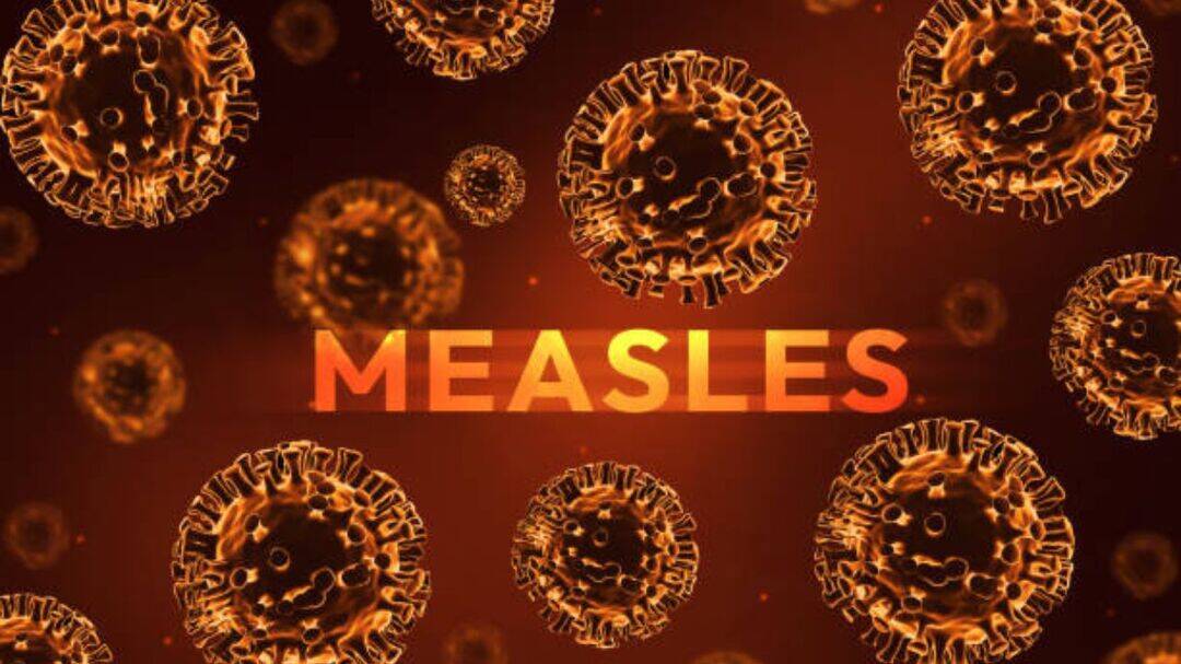 Measles outbreaks worsen in South Carolina, Arizona and Utah