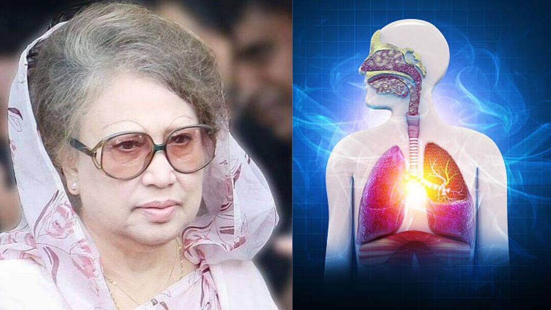 Khaleda Zia remains in critical condition in Dhaka hospital