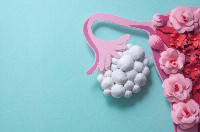 Why PCOD makes you feel tired