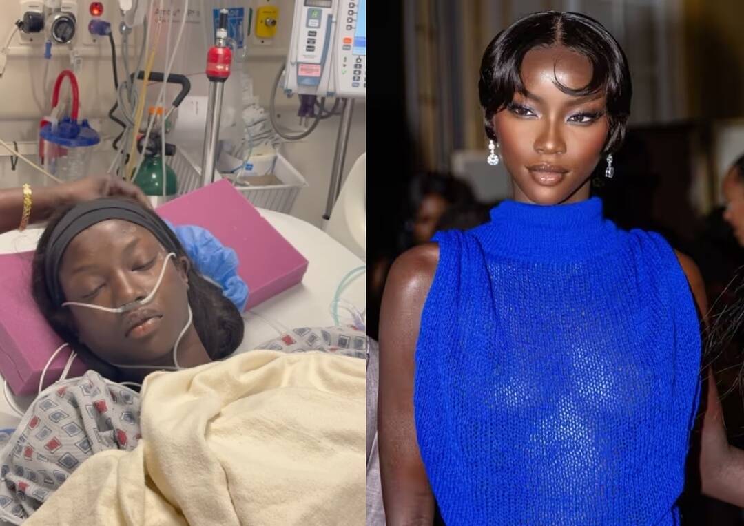 'Model of the Year' Anok Yai undergoes surgery for lung disease