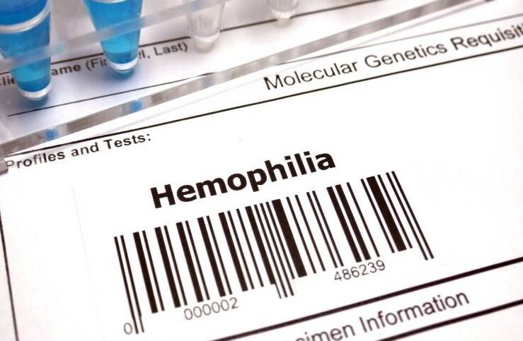 Haemophilia care shifts toward early prophylaxis