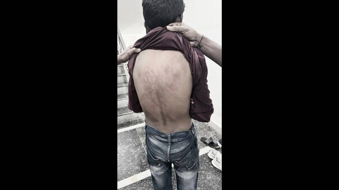 Class 7 boy thrashed on principal’s orders in Hyderabad