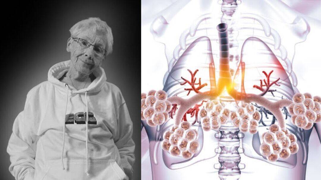 Epic gamer grandma Agnes dies after COPD battle