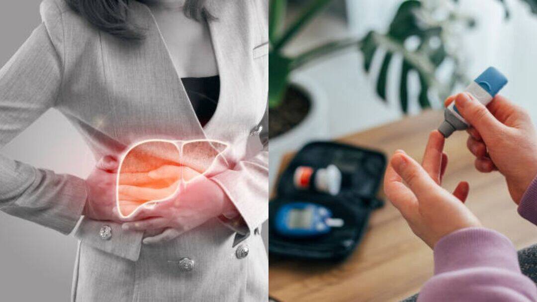 Expert reveals lifestyle changes to reverse early fatty liver