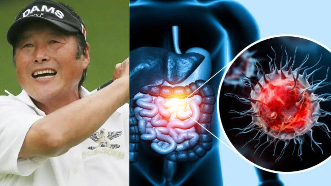 Japanese golfer Masashi Ozaki dies of sigmoid colon cancer at 78