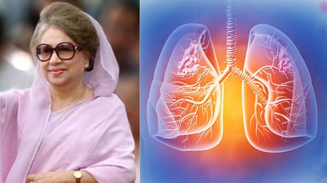 What illnesses led to Khaleda Zia’s death at 80?
