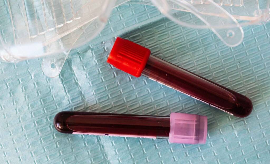 Doctors shocked to discover ‘male blood’ in woman post-miscarriage