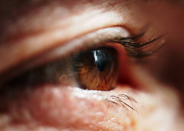 Why do some people pull out their eyelashes?