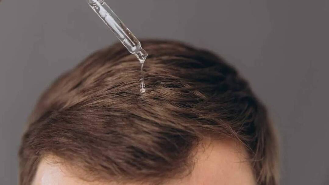 Hair loss drug linked to infant hair growth, adult eye disorders