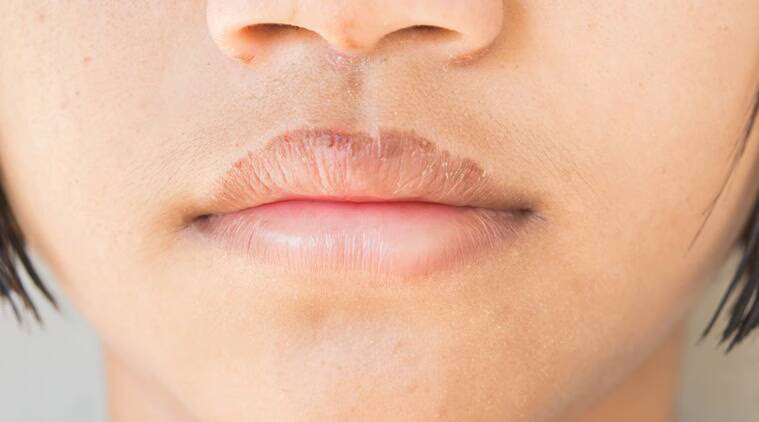 How can people protect and heal chapped lips in winter?