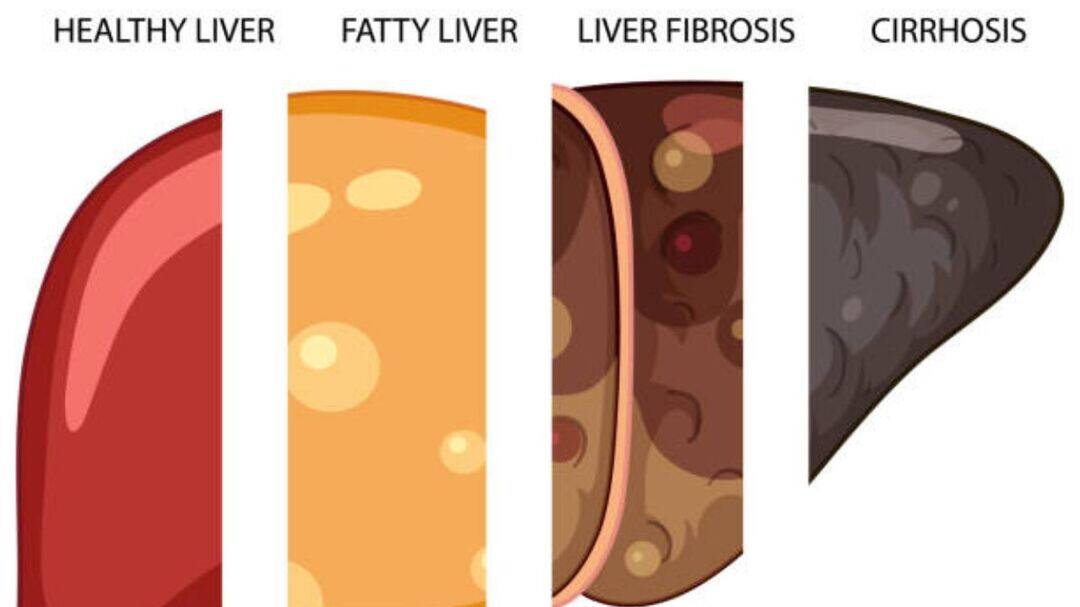 What are the early signs of liver damage?