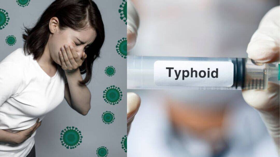 Why typhoid can occur even after drinking RO water?