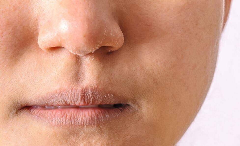 Dermatologist lists 5 things he would never do