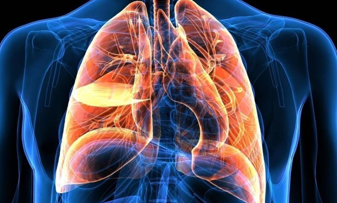 Lung cancer cases to rise sharply in India by 2030: Study 
