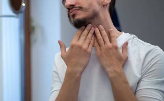 Why can't some men grow a beard?