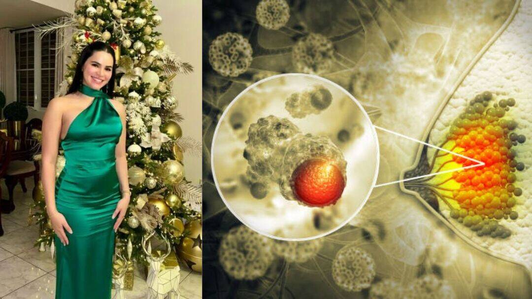Former Miss Puerto Rico shares breast cancer diagnosis at 33