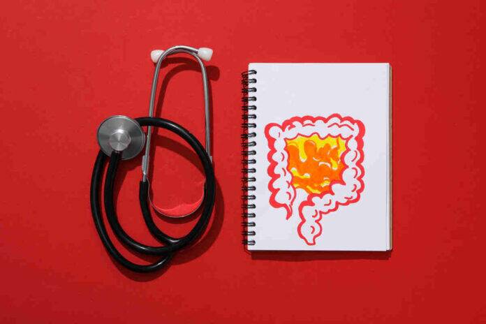 What are the early colorectal cancer cues one may miss?