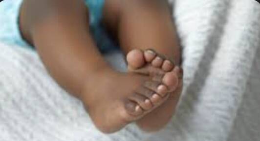 Nigerian baby with rare heart defect saved by bloodless surgery 