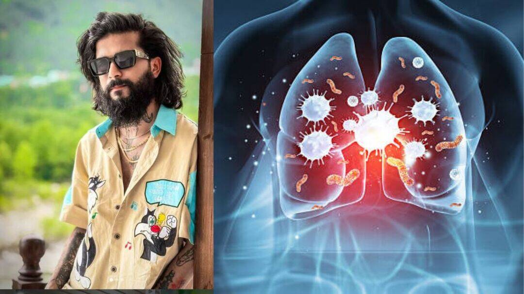 Anurag Dobhal’s severe pneumonia, how the infection attacks lungs