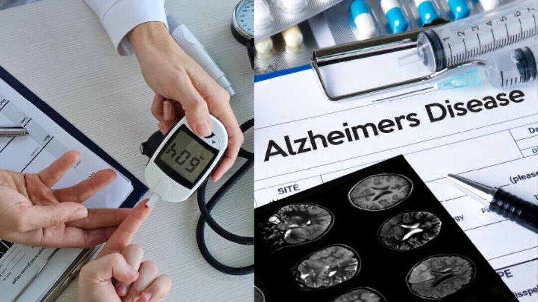 Diabetes can damage brain health causing dementia, say doctors