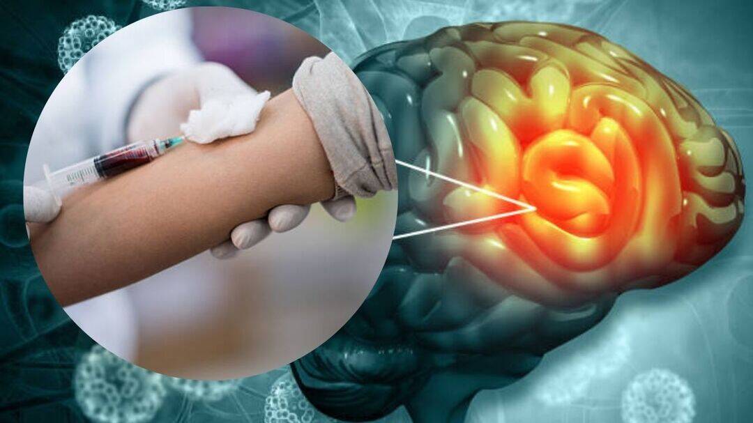 Blood test detects brain tumours with 90% accuracy