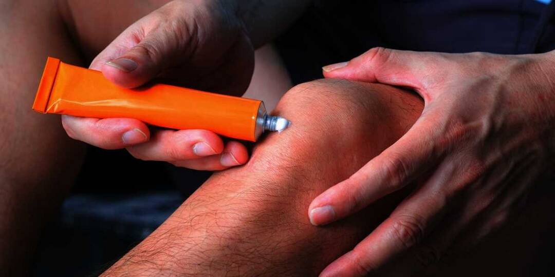 New fungal infection linked to steroid creams named after India