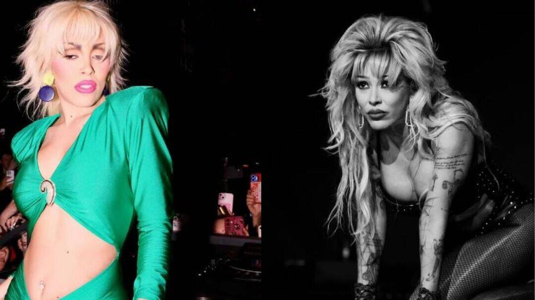 Singer Doja Cat reveals she may have Lipedema