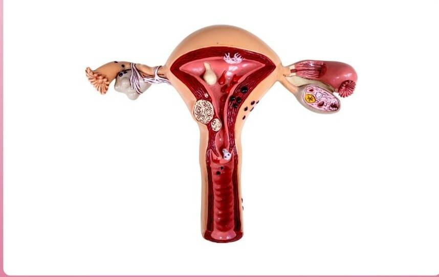 Why do vaginal dryness and pain occur in menopause?