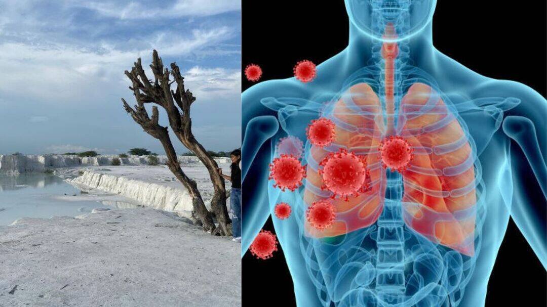 Rajasthan's 'mini Switzerland' poses lung risks: Doctors