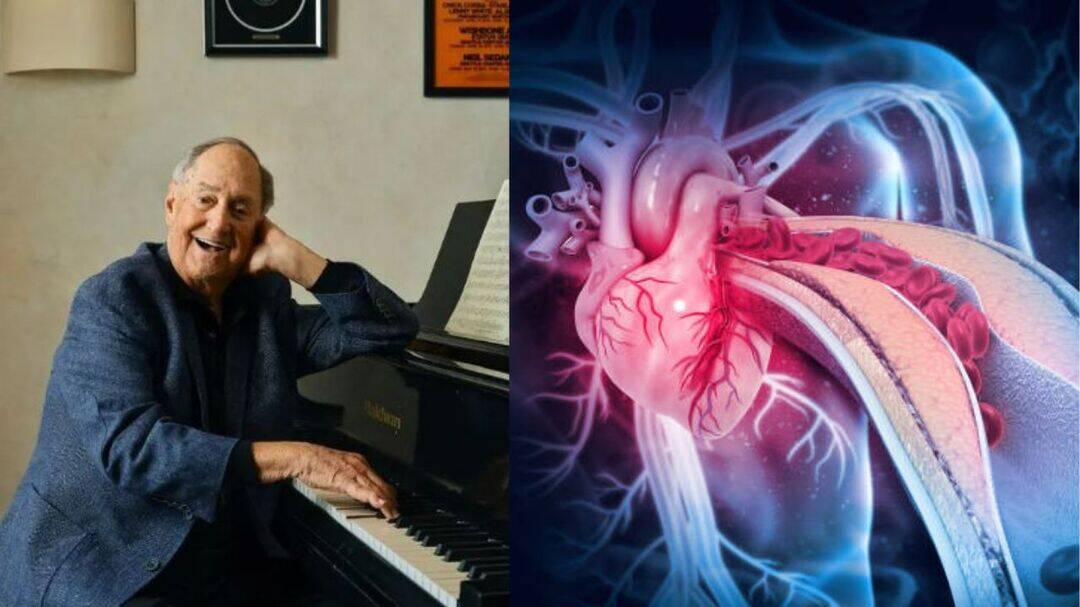 Legendary singer Neil Sedaka died of heart disease, kidney failure