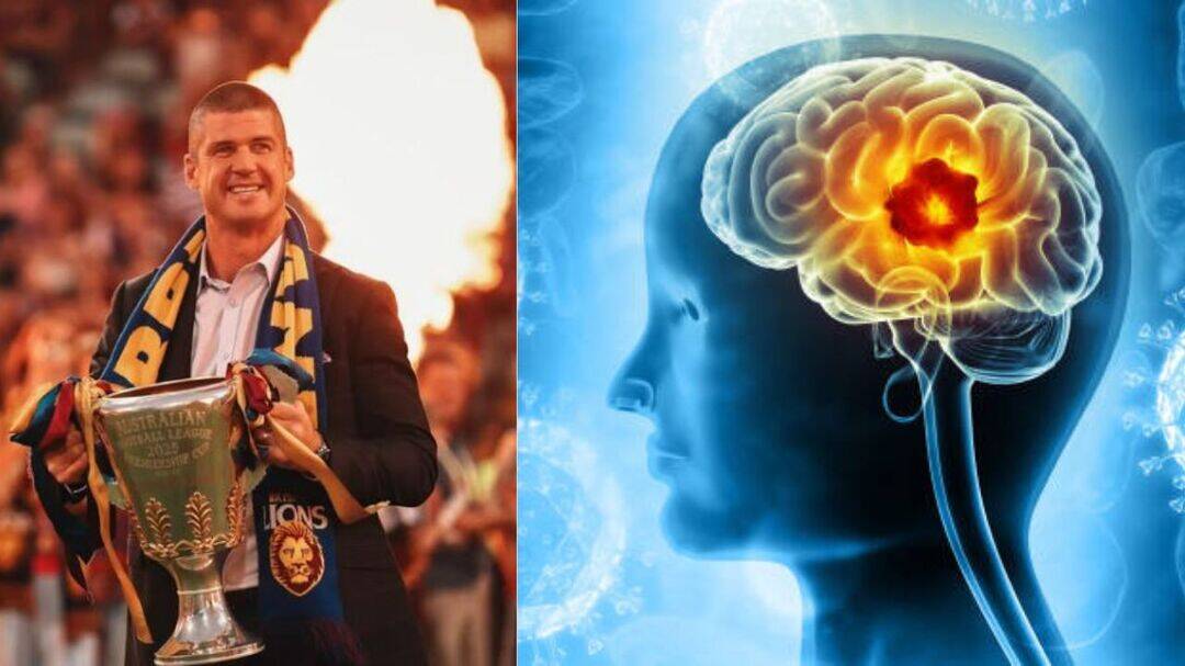 Jonathan Brown has brain surgery after a routine scan shock 