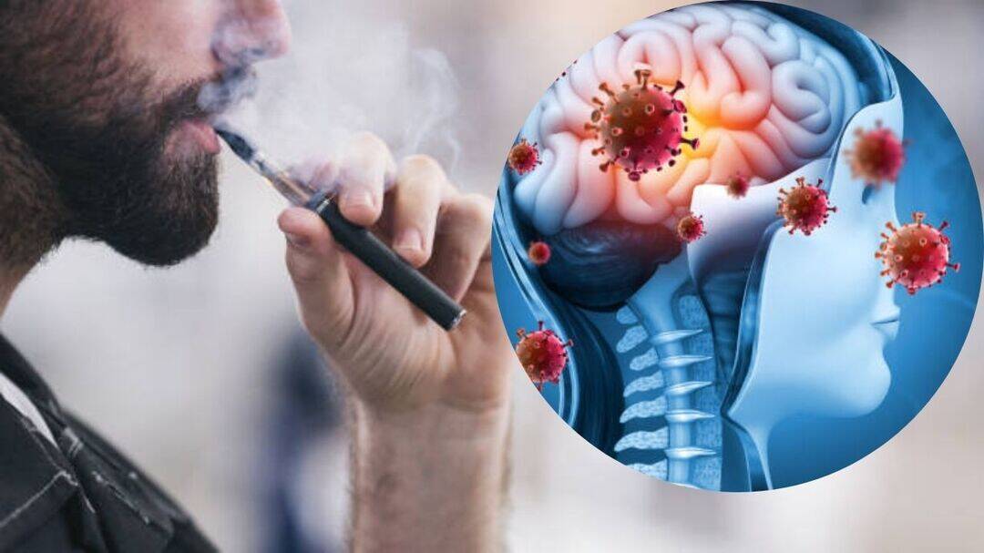 Is UK meningitis outbreak linked to vaping? 