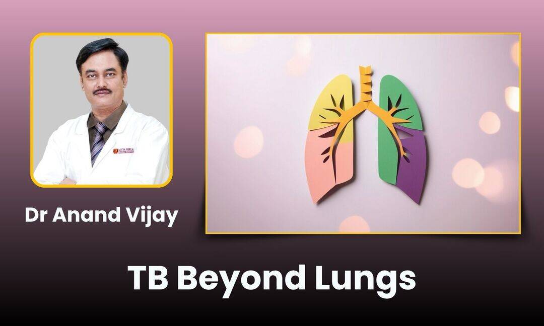 What is extrapulmonary TB?