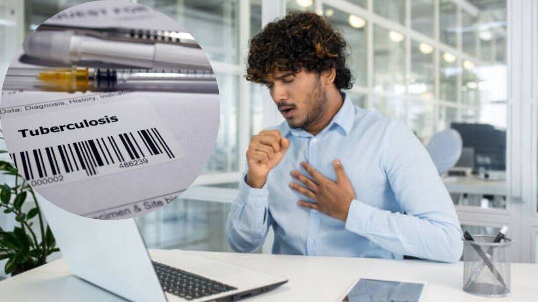 TB rising in young professionals, don't miss symptoms: Expert