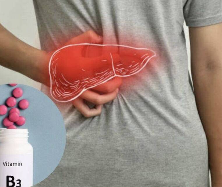 Vitamin B3 shows promise in reversing fatty liver: Study