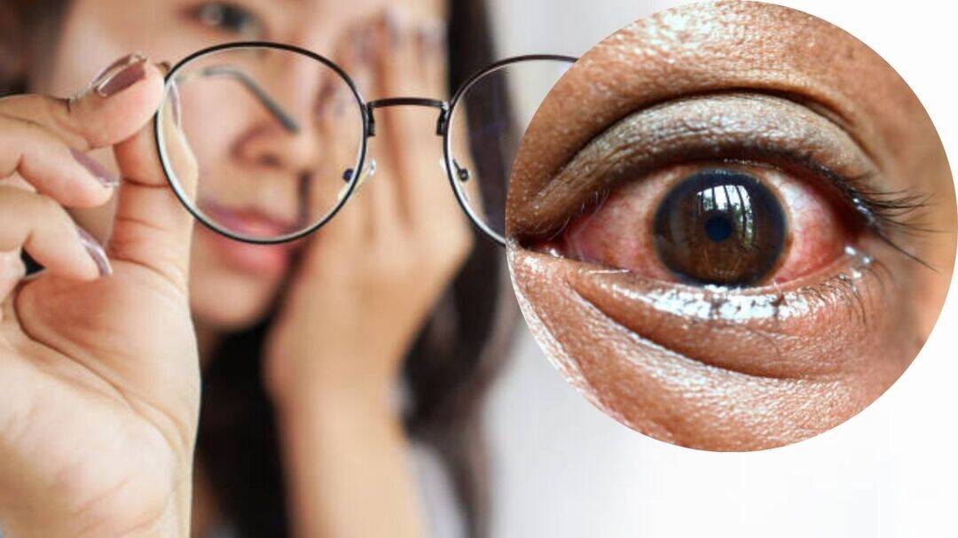 5 silent signs you must not ignore about your eyes