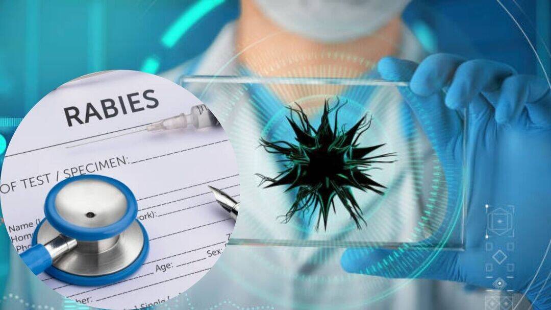 CDC halts rabies, mpox and virus testing