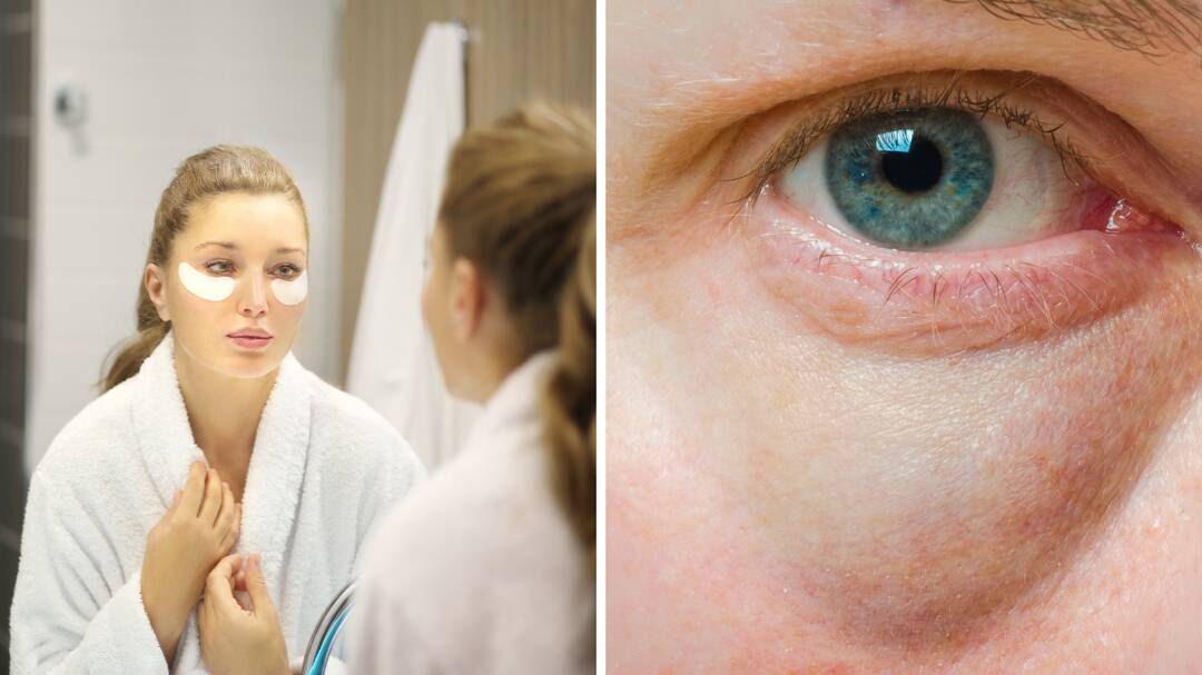 Do you have a puffy face in the morning? 