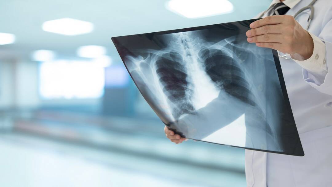 ICMR's ‘Make in India’ TB device used core parts from China